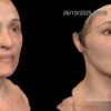 Side-by-side before-and-after portraits of a woman, showing facial skin improvement after cosmetic treatment; dates 04/08/2025 12:34 and 26/10/2025 13:19 appear at the top, with a QuantifiCare logo bottom-right.