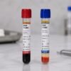 Two PRP tubes with red and blue caps stand on a lab bench, one with dark red fluid and the other with layered blood components.