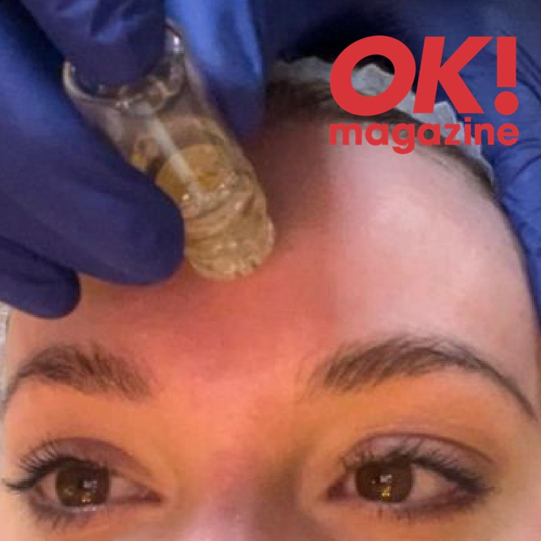 Close-up of a gloved hand pressing a small beige device against a woman's forehead, with OK! magazine watermark.