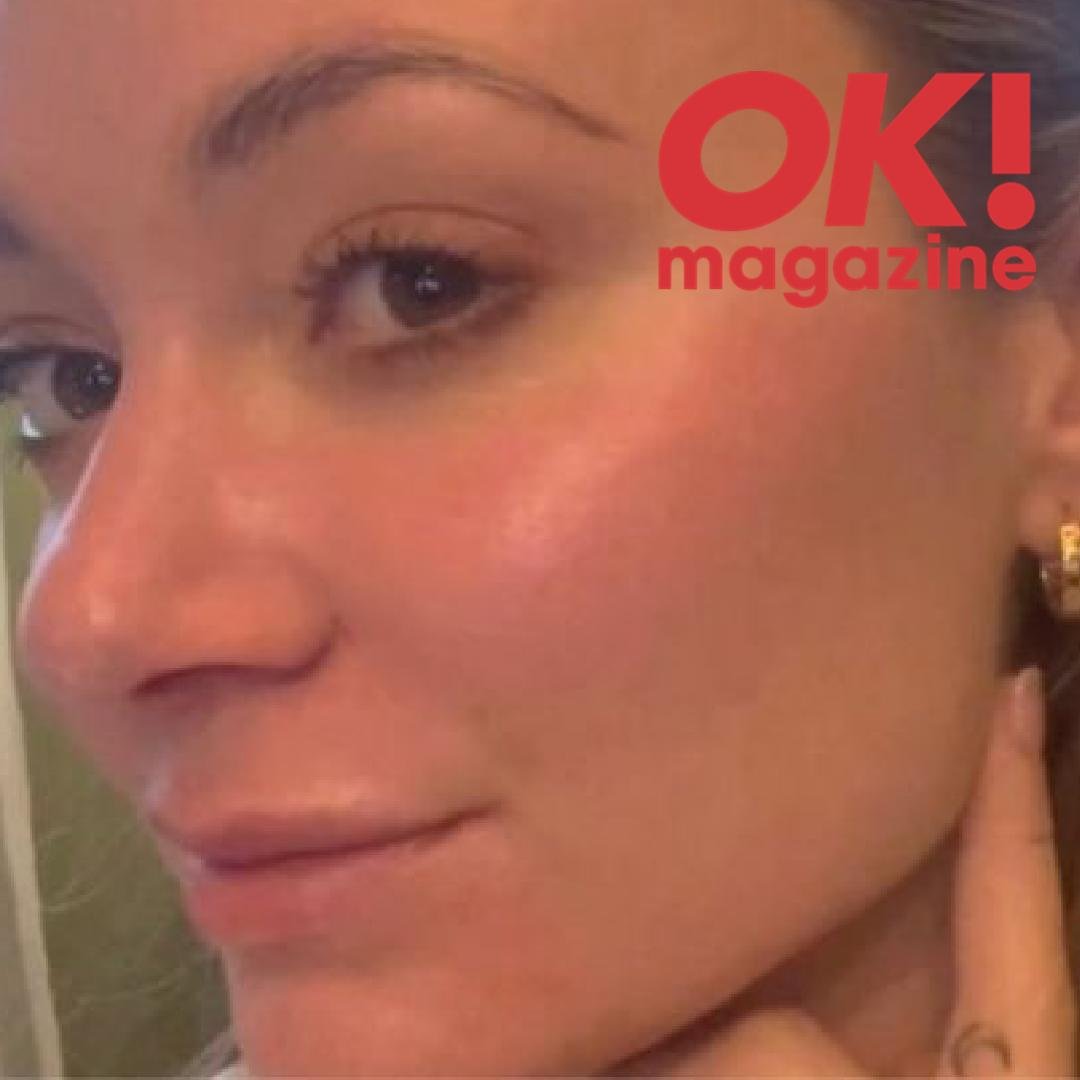 Close-up of a woman's face in profile with rosy cheeks and an OK! Magazine watermark in the top-right corner.