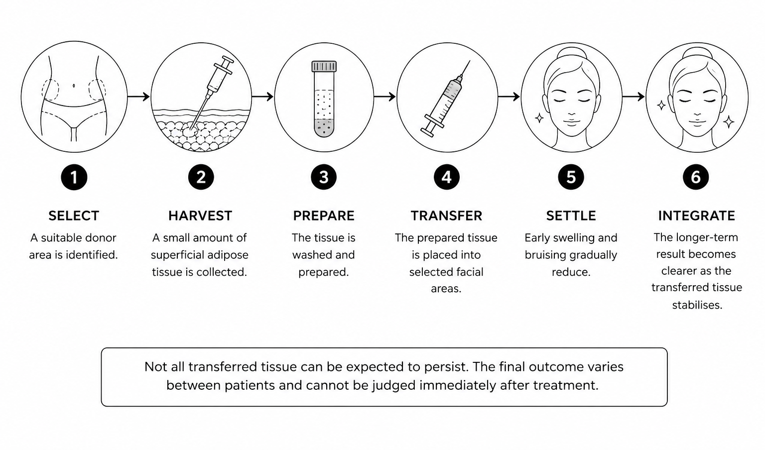 Six-step infographic illustrating tissue graft process from selecting donor area to tissue integration for facial restoration.