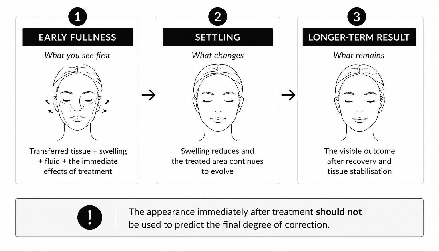 Three-panel infographic showing stages: 1) Early fullness — What you see first, with a face and arrows; 2) Settling — What changes, face image; 3) Longer-term result — What remains, face image.