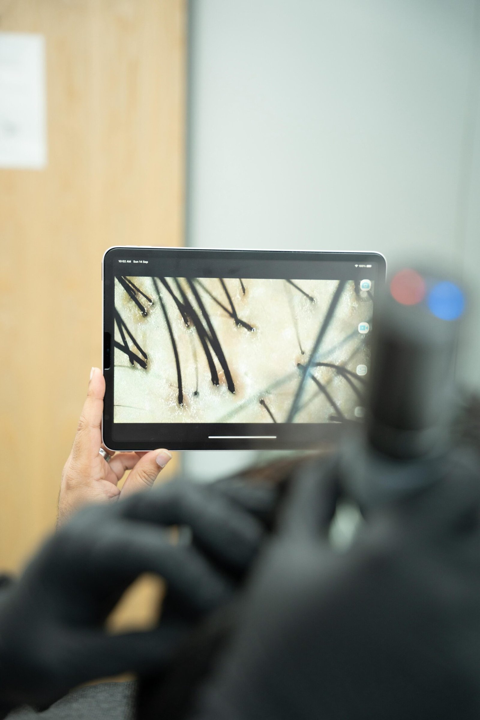 hair2 - Dr Hans Clinics - Dr Hans Clinics Close-up of a tablet screen showing a macro photo of dark plant stems against a pale background, held by a person