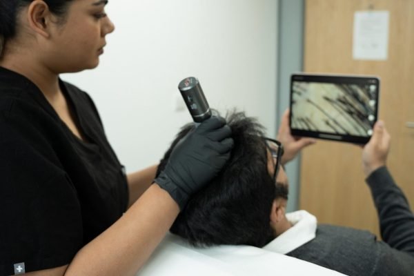 Trichology Consultation, Hair restoration, Dr Hans Clinics, London